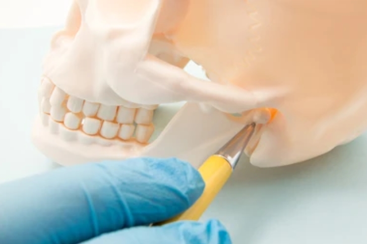 Mandibular reconstruction (fibula, scapula, DCIA, etc.)